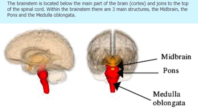 DIPG. The brain stem is located below the main part of the brain (cortex) and joins to the top of the spinal cord. Within the brain stem there are three main structures, the Midbrain, the Pons and the Medulla oblongata.