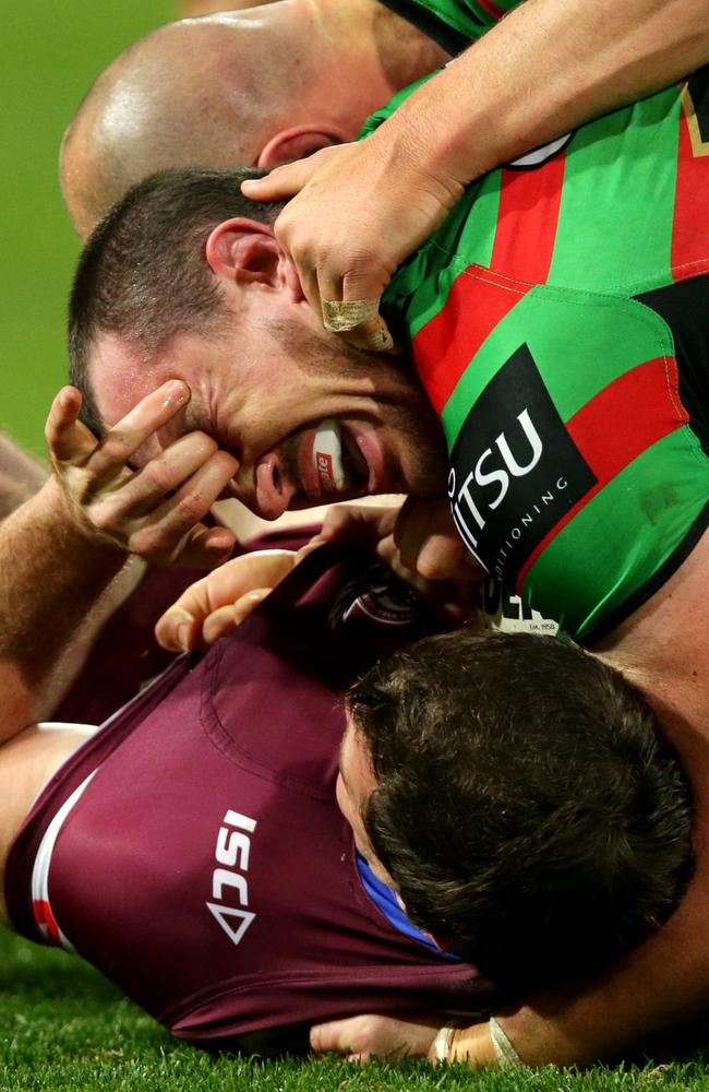 Josh Starling is free to play on Sunday despite this nasty looking picture of an eye gouge. Pic: Gregg Porteous