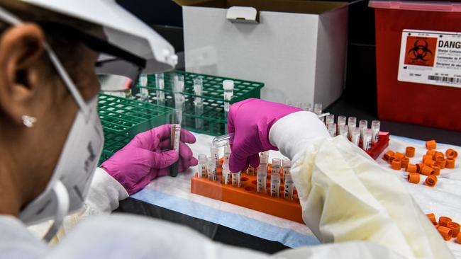 A lab technician sorts blood samples inside a lab for a COVID-19 vaccine study at the Research Centers of America. Picture: AFP