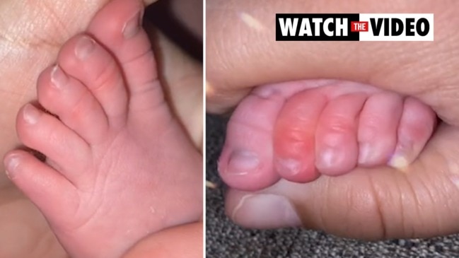 TikTok mum details frightening find on baby's toe: 'Another fear unlocked