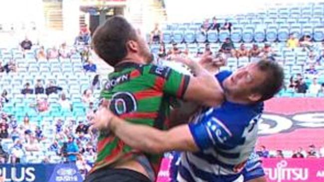 Burgess missed two weeks for the elbow.