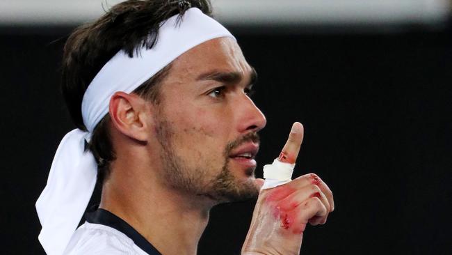 Fabio Fognini's hand after his win against Jordan Thompson. Picture: Mark Stewart