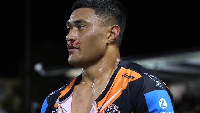 SYDNEY, AUSTRALIA - JULY 06: Stefano Utoikamanu of the Wests Tigers leaves the fiels with a bloody nose and ripped shirt during the round 18 NRL match between Wests Tigers and Melbourne Storm at Leichhardt Oval, on July 06, 2024, in Sydney, Australia. (Photo by Scott Gardiner/Getty Images)