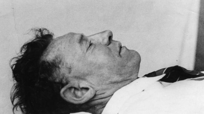 Photographic reconstruction by police photographer Durham of the body of the unknown man found dead on Somerton Beach, which was released to the press in December 1948.