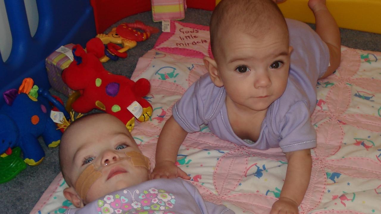 My twins spent 107 days in hospital – this is their wonderful life now