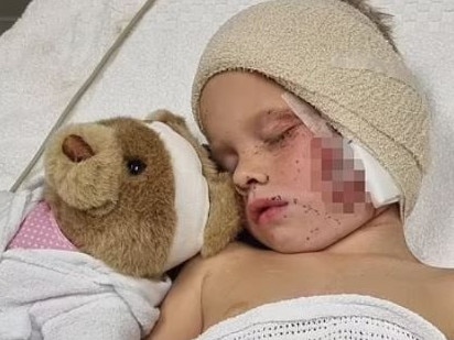 ‘Thought he was going to die’: Dad of boy savaged by dog speaks