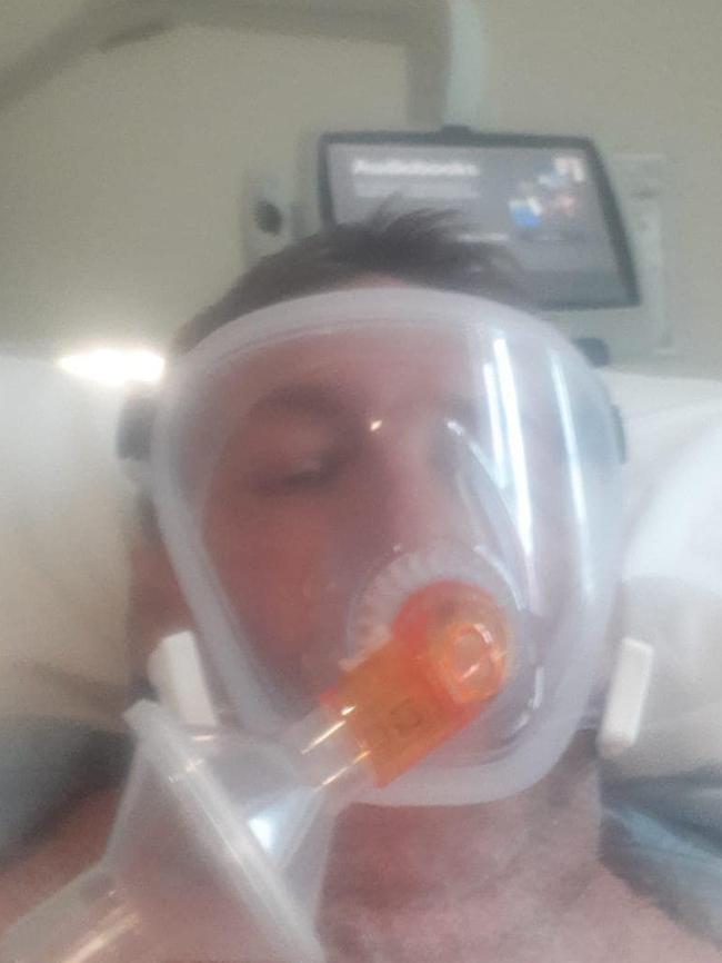 A patient on a ventilator. Currently, fatality rates for those on ventilators can be 60 per cent, says Boyes. Picture: Supplied