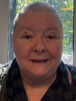 The Aussie icon took to social media revealing her bald head. Picture: Supplied