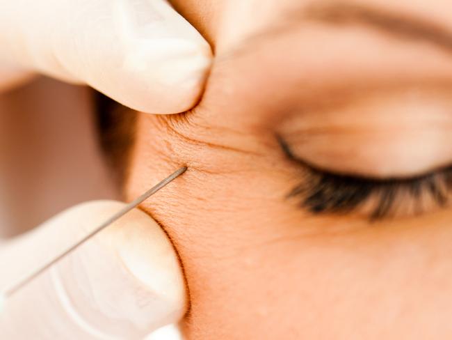 Closeup of botox injection in wrinkle near eye