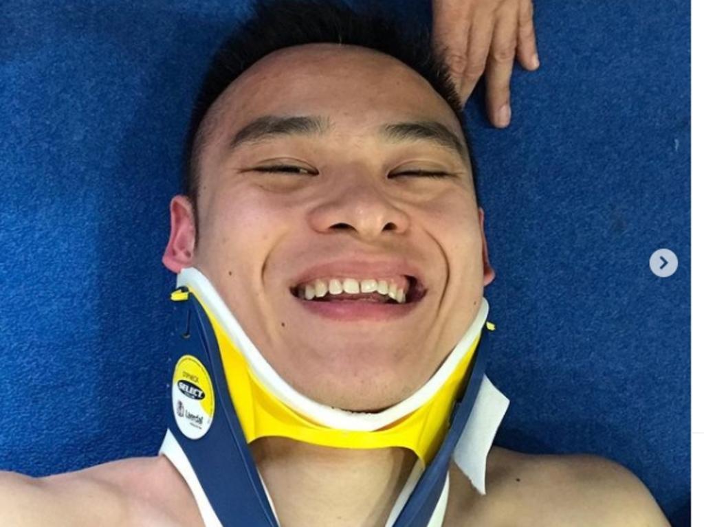 Shixin Li broke a bone in his neck earlier this year.