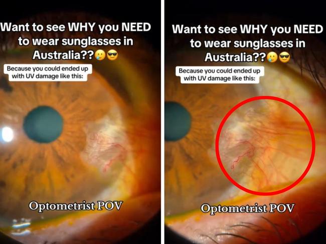 UV exposure can cause long-term damage to vision. Picture: TikTok