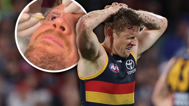 AFL 2024: Rory Sloane's eye surgery