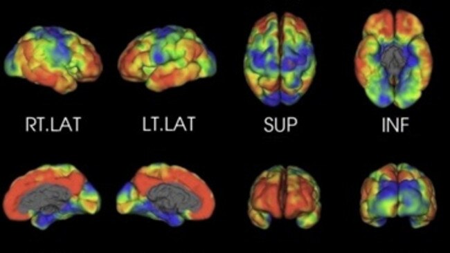 A CSIRO brain scan.