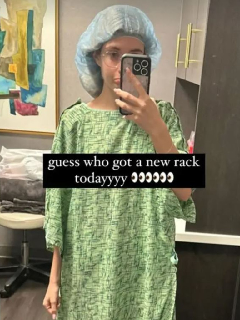 The social media star revealed to her followers at the time that she “got a new rack”.
