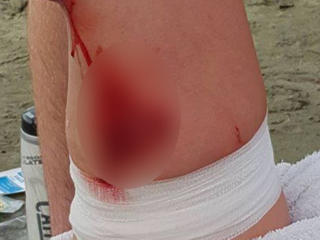 A teenager was stabbed by a stingray while bodyboarding at a New Zealand beach.