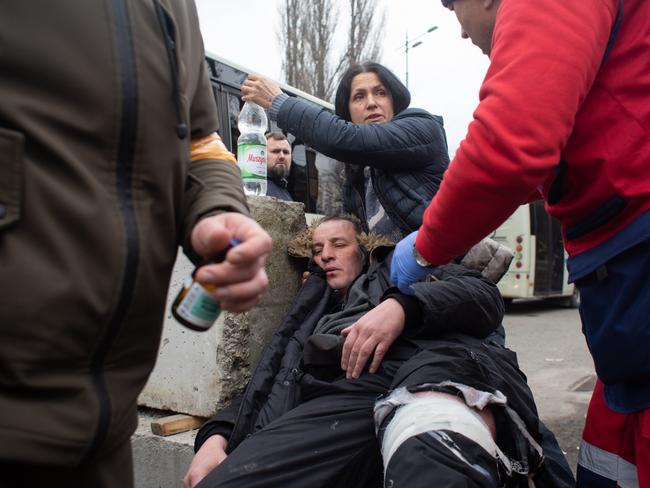 Yuriy, who was shot in the leg while evacuating civilians from the shelled city of Irpin receives first aid in Kyiv, Ukraine. Picture: Getty Images