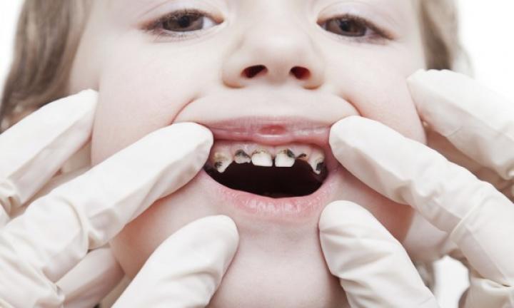 How Your Child's Sippy Cup Can Lead to Tooth Decay