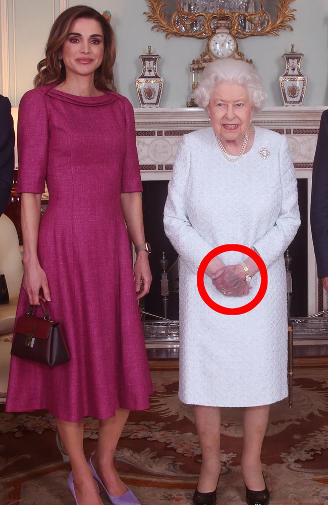 Rania of Jordan, Queen Elizabeth II and King Abdullah II of Jordan during a private audience at Buckingham Palace, where her hand looks strangely bruised. Picture: Yui Mok - WPA Pool/Getty Images