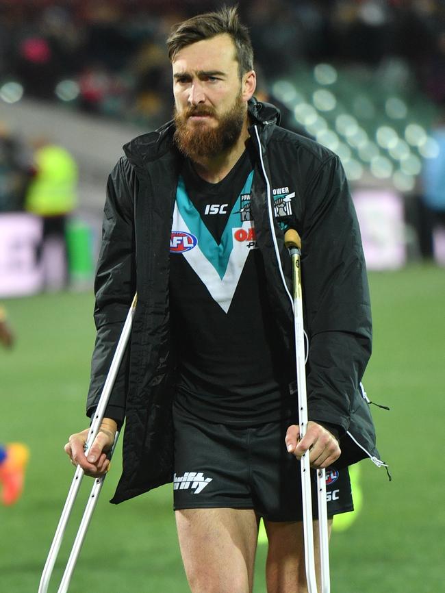 Charlie Dixon on crutches after the match.