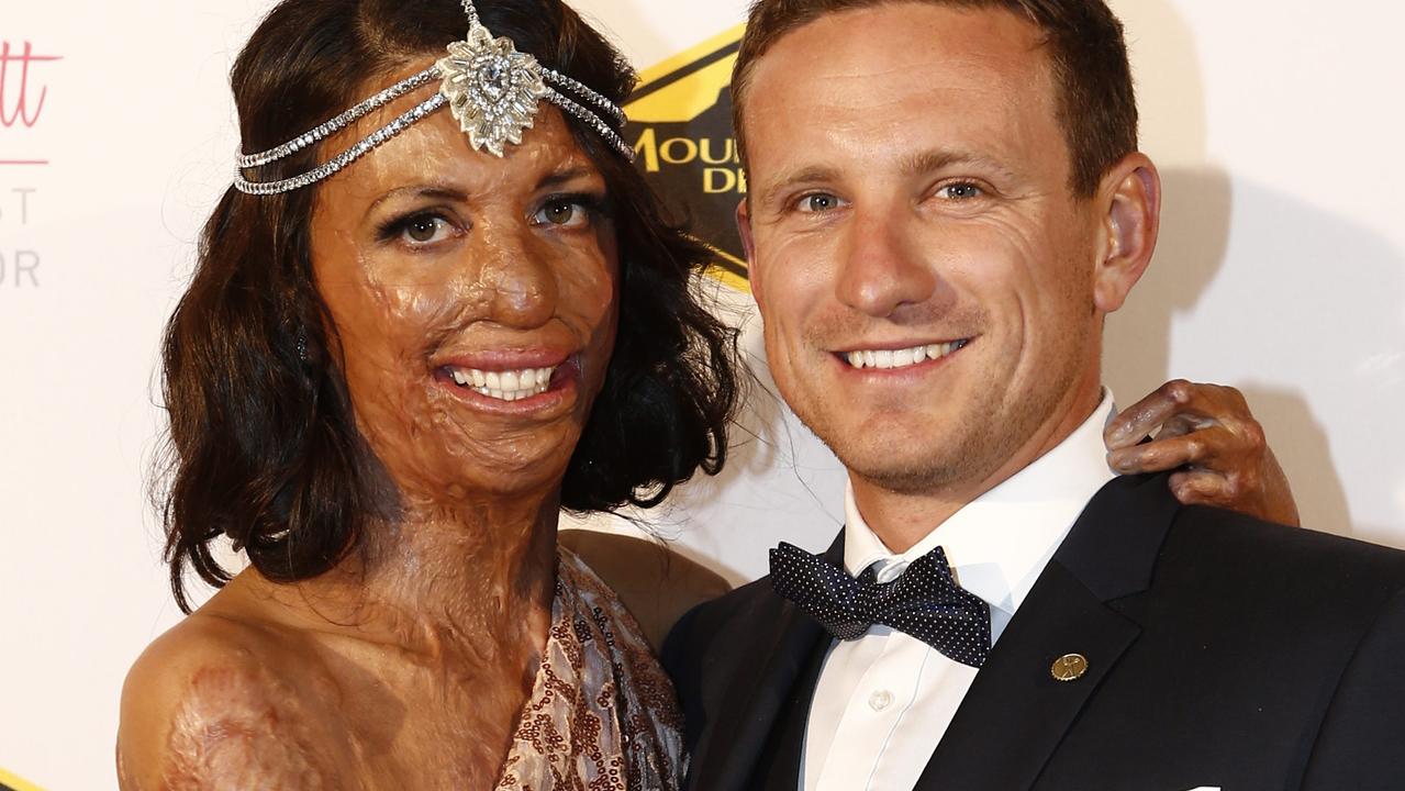 Turia Pitt Engaged To Long Term Partner Michael Hoskin The Australian 9546