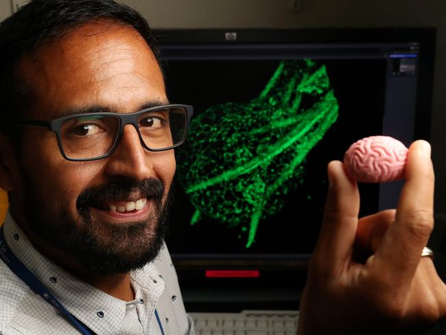 21/02/18 Dr Guillermo Gomez in his lab at the Centre for Cancer Biology in the city who is using human stem cells to create minibrain models of glioblastoma (a type of brain cancer) to identify the drivers underpinning the most traumatic and devastating phases of this disease. Dr Gomez holding a rubber brain toy.  picture CALUM ROBERTSON