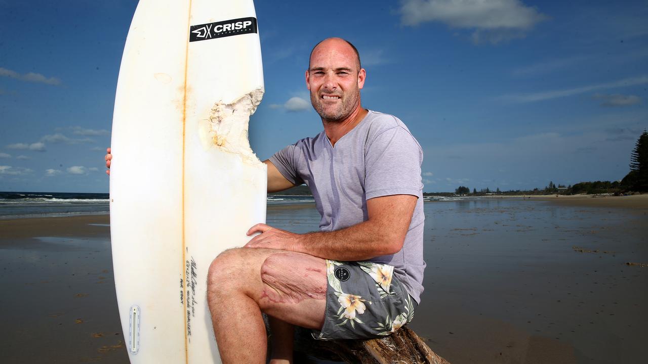 SA shark attack victim Sam Edwardes tells his story | Daily Telegraph