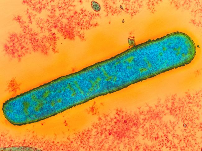 Bacillus anthrax bacterium cells. disease germs bacteria