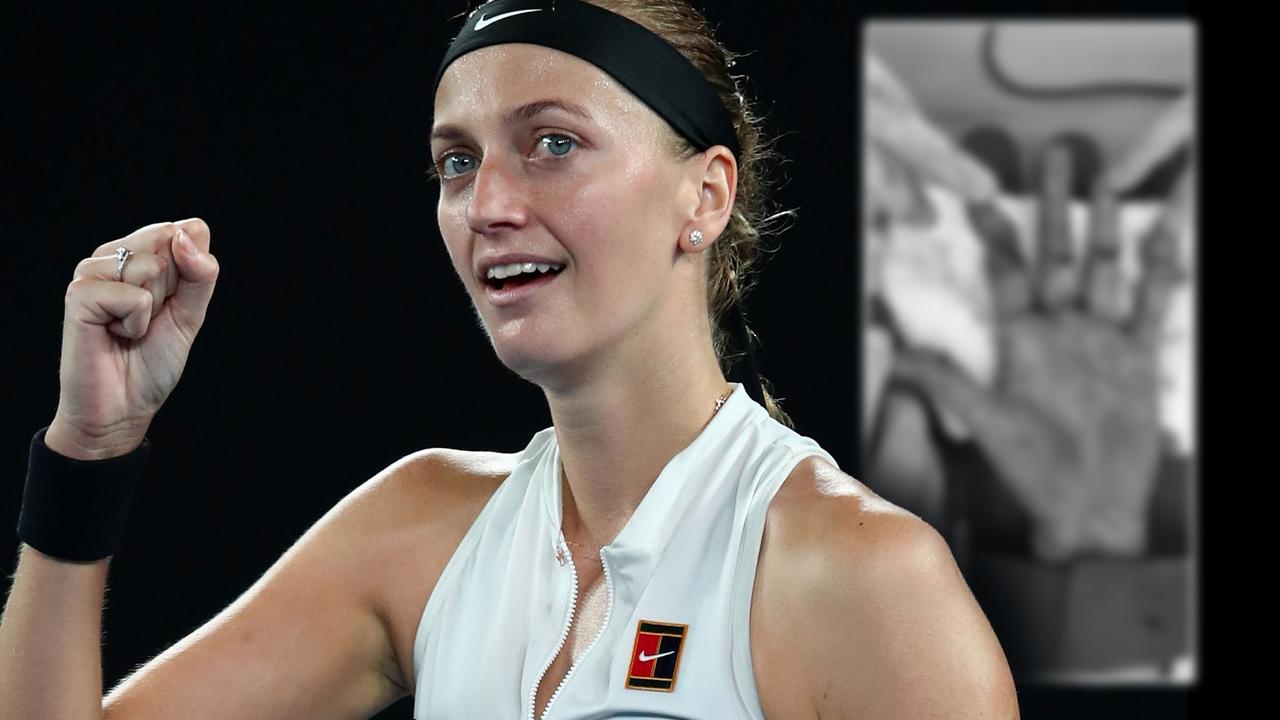 Australian Open 2019 Petra Kvitova Comeback From Stabbing Hand Photos Final Vs Naomi Osaka