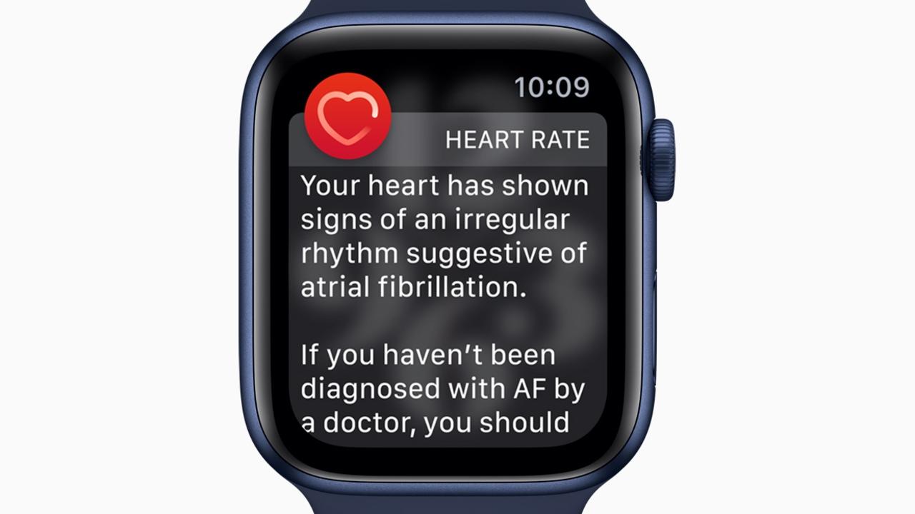 Apple watch best sale ecg api