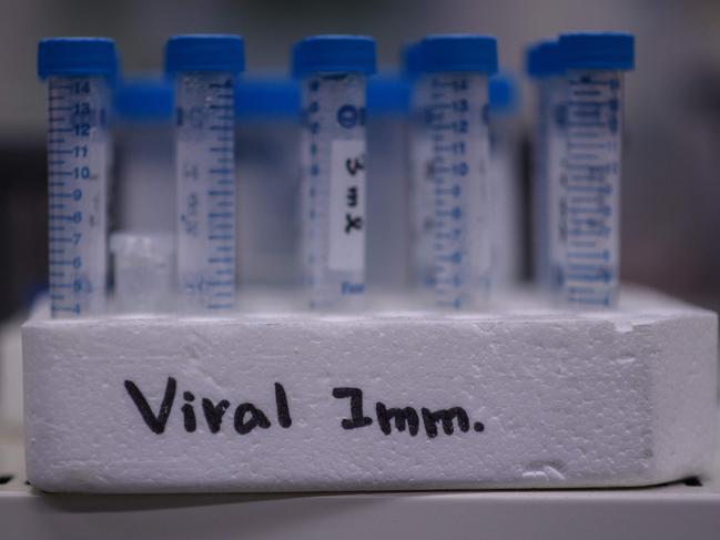 This photo taken on March 11, 2020 shows vials displayed during a neutralising antibody test on the Middle Eastern Respiratory Syndrome (MERS) coronavirus at a Bio Safety Level (BSL) 3 laboratory at the International Vaccine Institute (IVI) in Seoul. - The COVID-19 novel coronavirus outbreak has exposed a lack of global research on ways to combat the spread of infectious diseases, with health authorities failing to learn lessons from previous flare-ups, experts said on March 3. The last outbreak of worldwide signficance was the SARS virus scare of the early 2000s, which killed 774 people, and more recently the Mers virus killed more than 850 people, although the outbreak was largely contained to the Middle East. (Photo by Ed JONES / AFP)