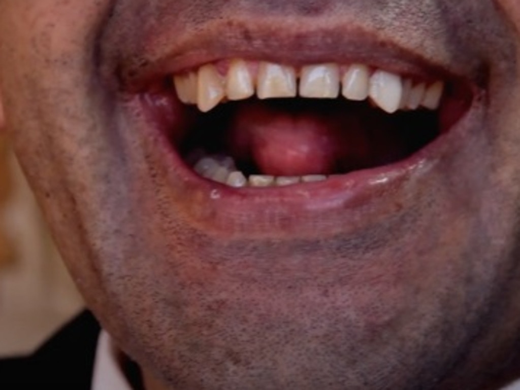 He had his fangs surgically enhanced. Picture: YouTube