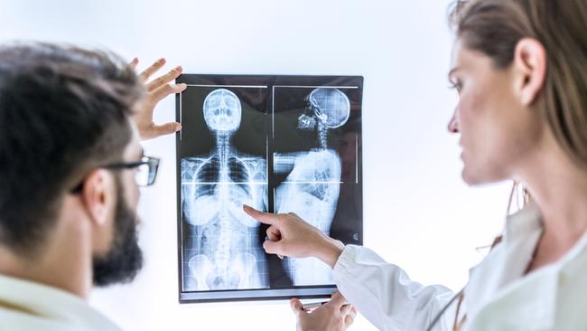 Women at risk of breast cancer will be able to get a more accurate diagnosis. Picture: iStock