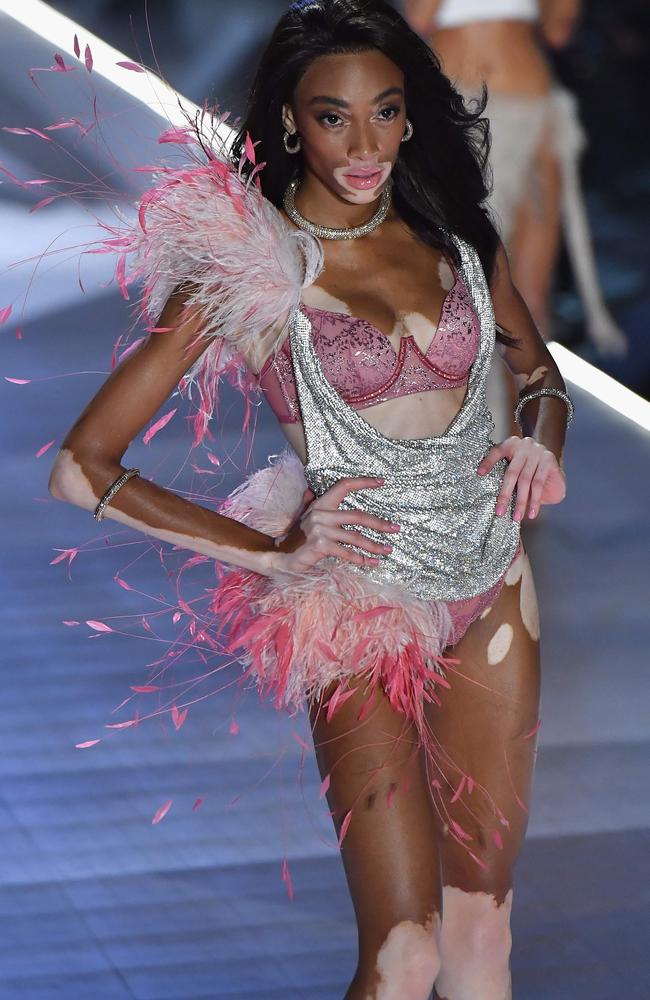 Canadian model Winnie Harlow walks the runway at the 2018 Victoria’s Secret Fashion Show on November 8, 2018 at Pier 94 in New York City.