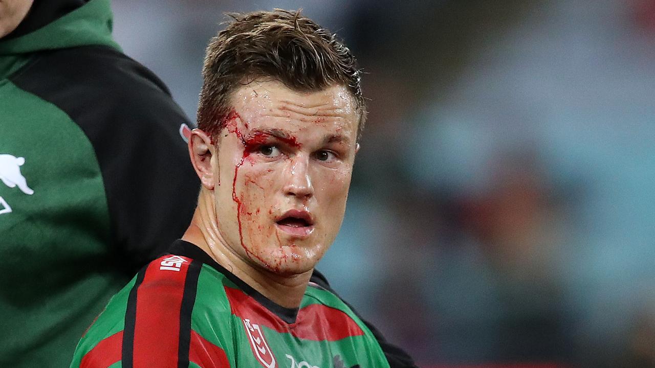 Rabbitohs player Liam Knight leaves the field after being knocked out by Jared Waerea-Hargreaves’ shoulder.