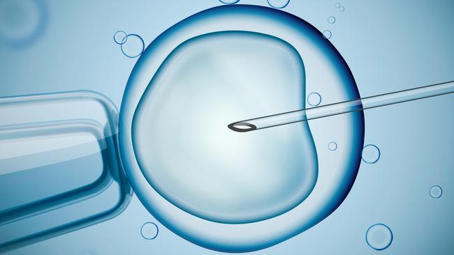 Publicly available outcome data is limited, even though IVF can cost tens of thousands of dollars. Picture: iSTOCK
