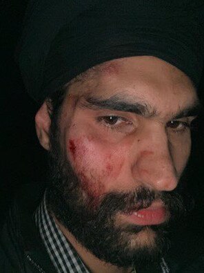 Taxi driver Jaspreet was left with these facial injuries after being attacked with a bottle by a group of teenagers on the weekend. Picture: 13cabs