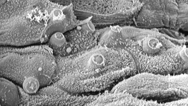 Electron microscope image of surface of frog skin covered by chytrid fungus, with fungal tubes poking through the skin (arrow) (Photograph by Lee Berger)