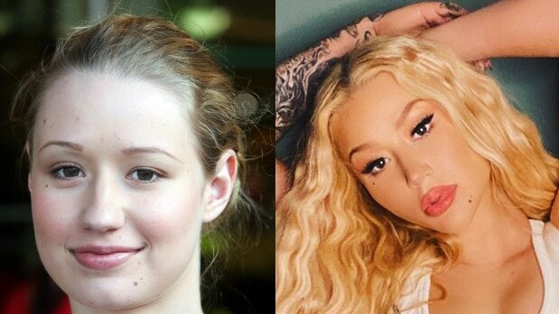 Iggy Azalea before and after becoming famous. Photo: file.