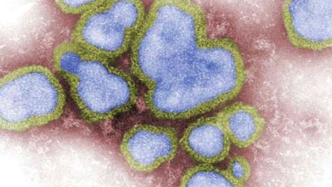 Influenza A strain under microscope