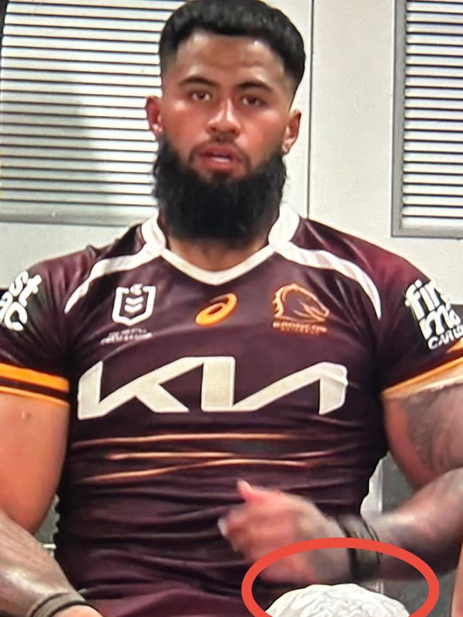 NSW and Broncos star Payne Haas with ice on his quad post-game. Picture: Fox League