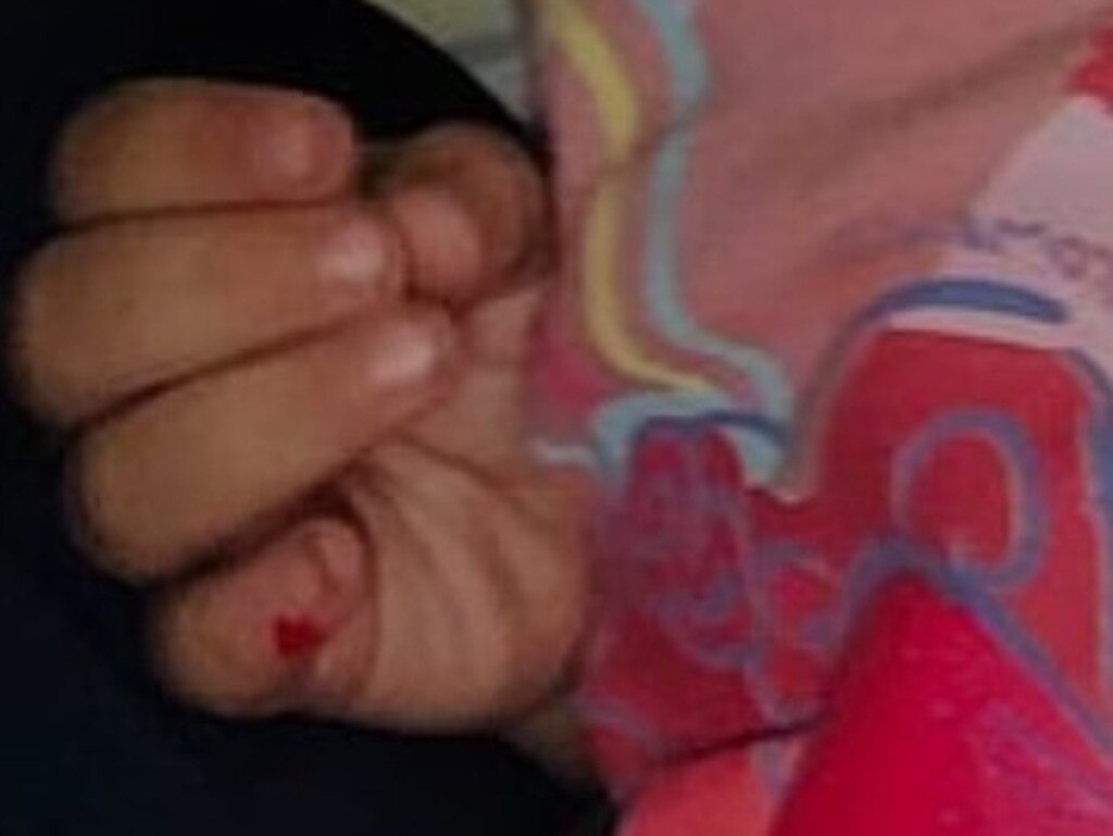 A zoomed in photo appears to show blood on Adelynn’s finger.