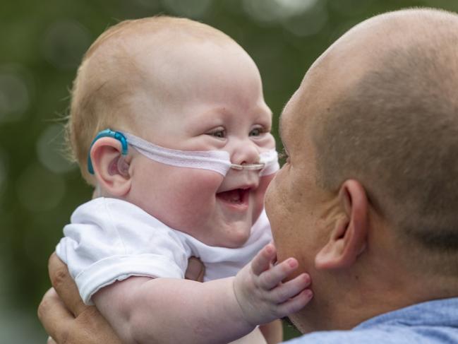 Levi Atkinson was born at 24 weeks and spent months in NICU at Darwin and Brisbane. Picture: Floss Adams