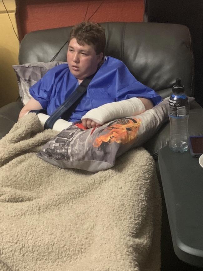 Beau Medcraft recovering a week after the incident. Picture: Supplied