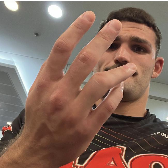 Nathan Cleary shows off his dislocated finger.