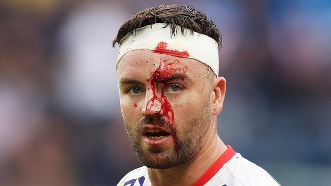 Warriors star Wayde Egan was bleeding heavily after he was kneed in the head. Picture: Mark Metcalfe/Getty Images