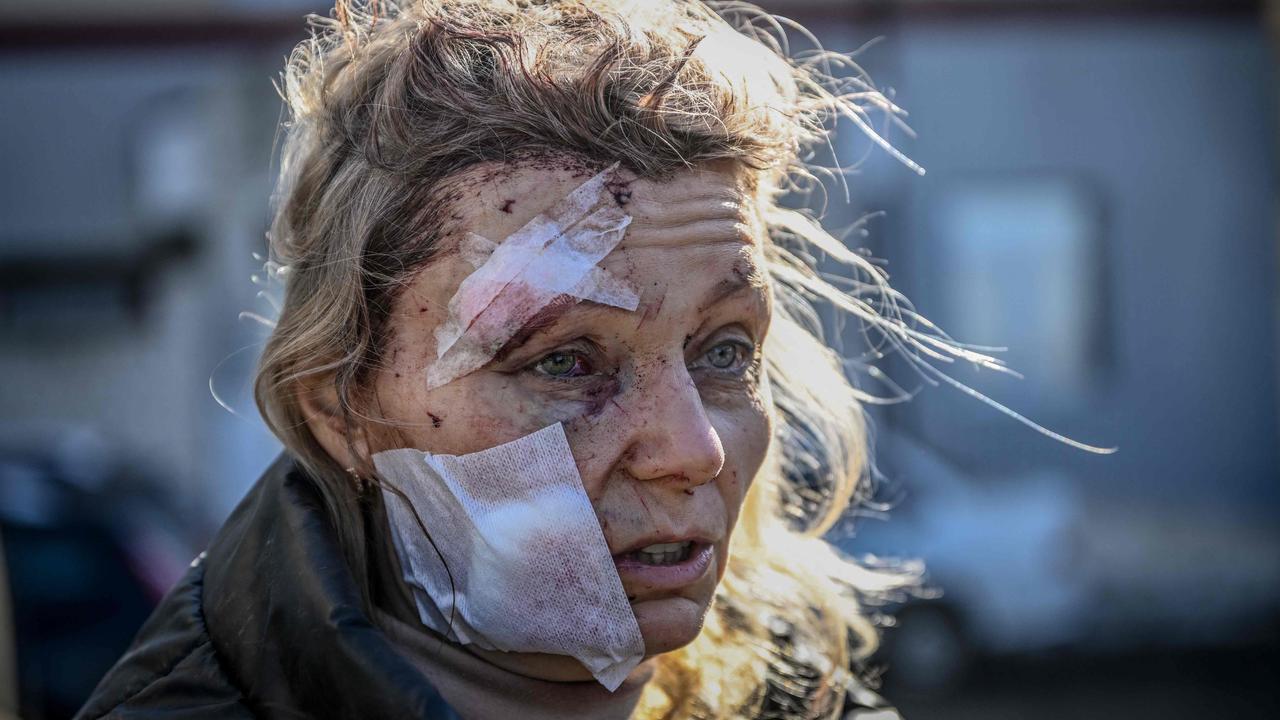 A wounded woman stands outside a hospital after the bombing of the eastern Ukraine town of Chuguiv. Picture: Aris Messinis/AFP