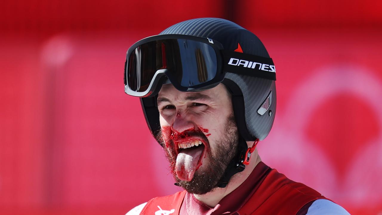 YANQING, CHINA – FEBRUARY 07: Daniel Hemetsberger of Team Austria reacts with blood on his face following the Men's Downhill on day three of the Beijing 2022 Winter Olympic Games at National Alpine Ski Centre on February 07, 2022 in Yanqing, China. (Photo by Alex Pantling/Getty Images)