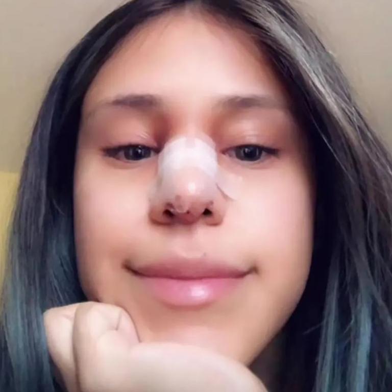 When her boyfriend cheated, this TikToker asked for a new nose. Picture: TikTok