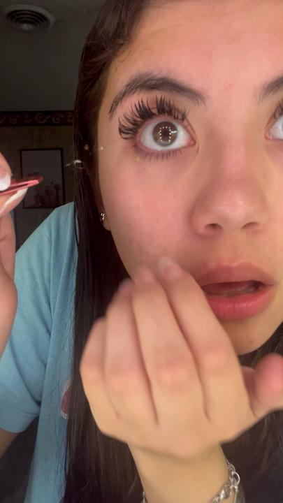 Woman has ‘hairy’ situation in her eye
