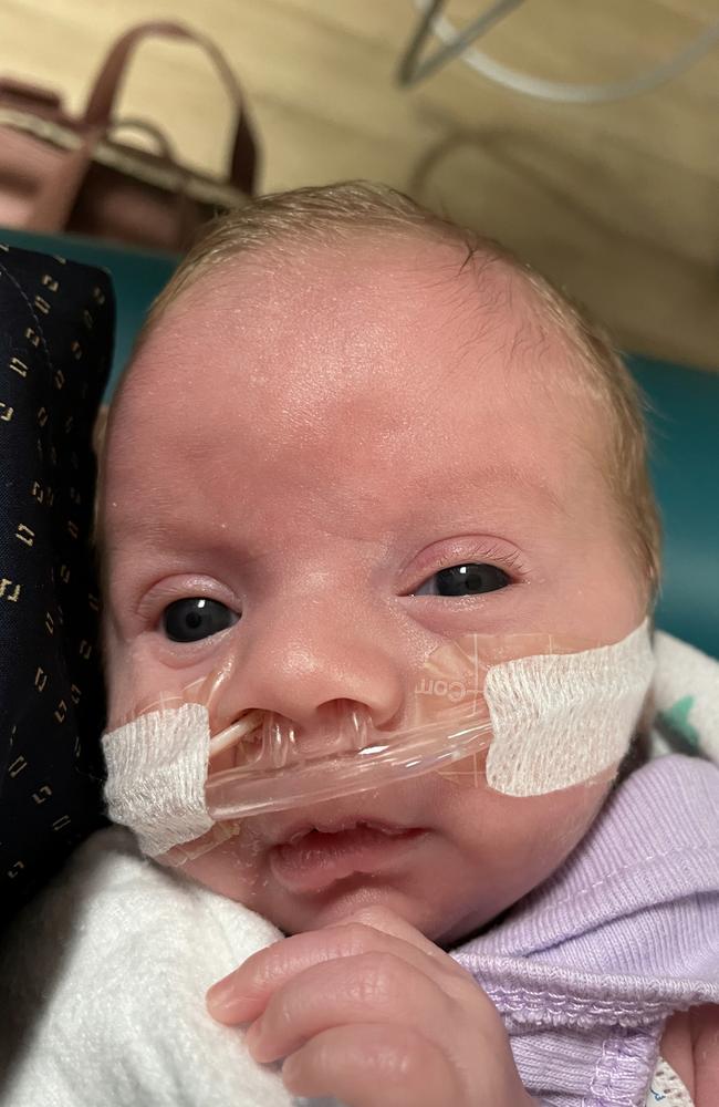 Little baby Saylor Thomson was born three months early with a tumour ...